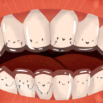 Cartoon image of Invisalign clear aligners to straighten teeth