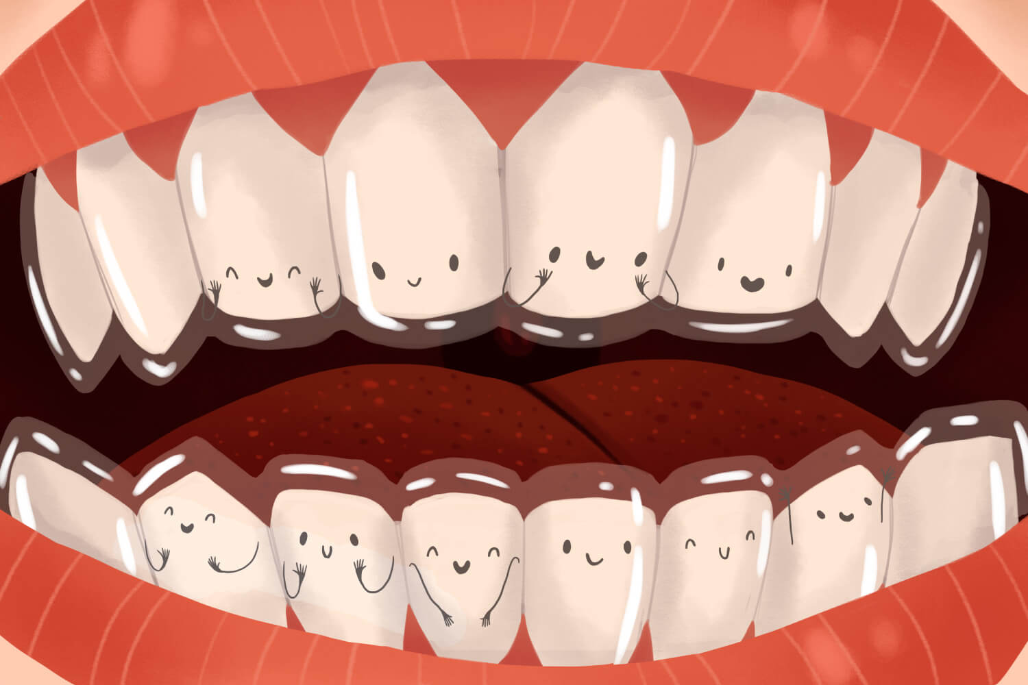 Cartoon image of Invisalign clear aligners to straighten teeth
