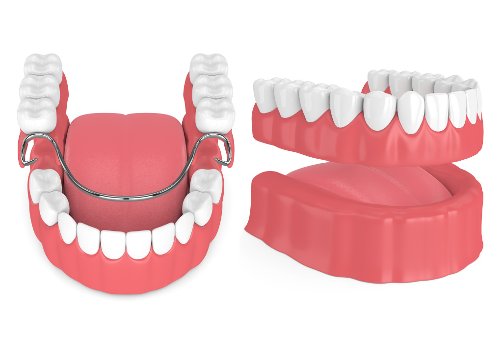 Partial dentures next to full dentures